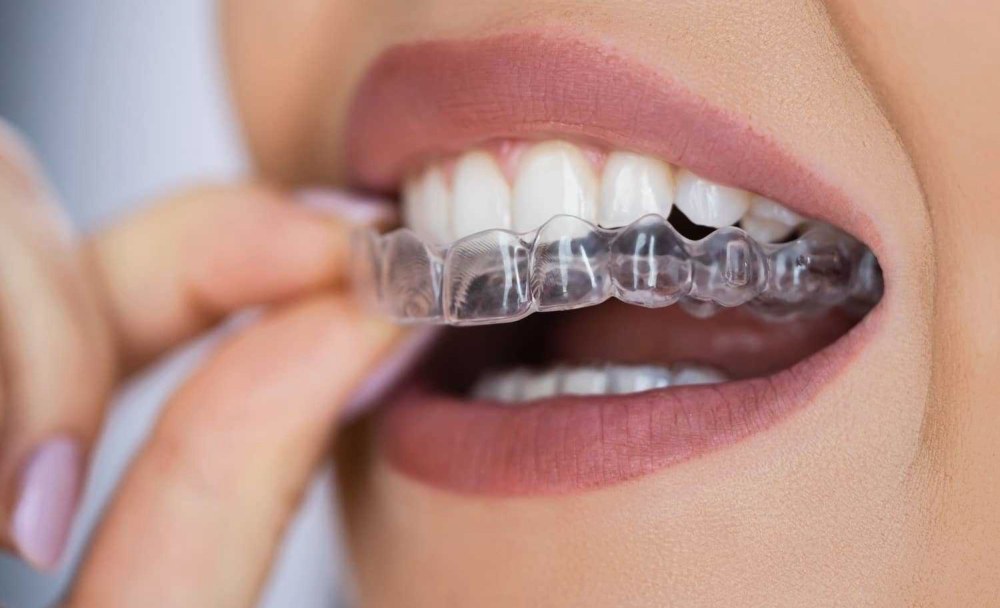 brillant.dental Brillant Dental